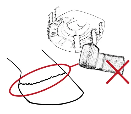 Die Cast-Bandage darf  den Kronrand des Hufes nicht bedecken