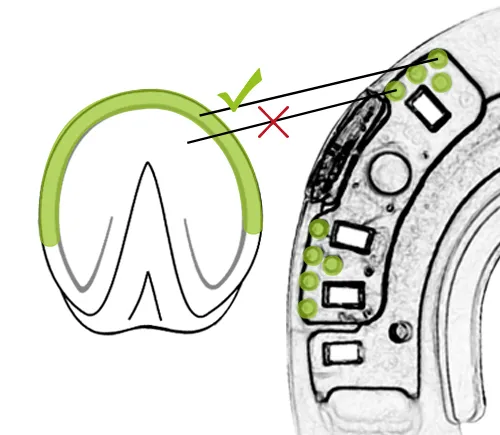 Die Noppen auf der Hufseite des Duplo-Beschlags müssen im Bereich des Tragrands platziert werden, nicht im empfindlichen Sohlenbereich.