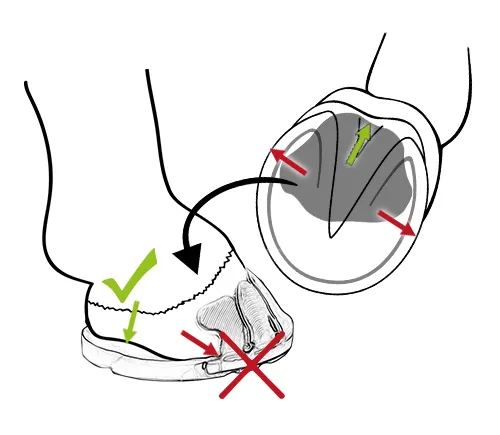 Warnung: Überschüssiges Polstermaterial darf nur im Trachtenbereich austreten und nicht seitlich im Bereich der Klebefläche am Huf