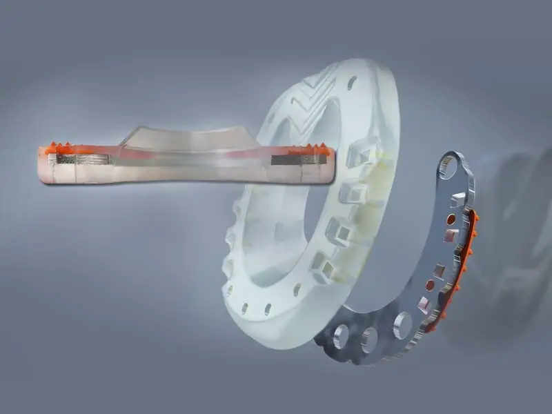 composite horse shoe - made up of a metal inlay and surrounding plastic sheath